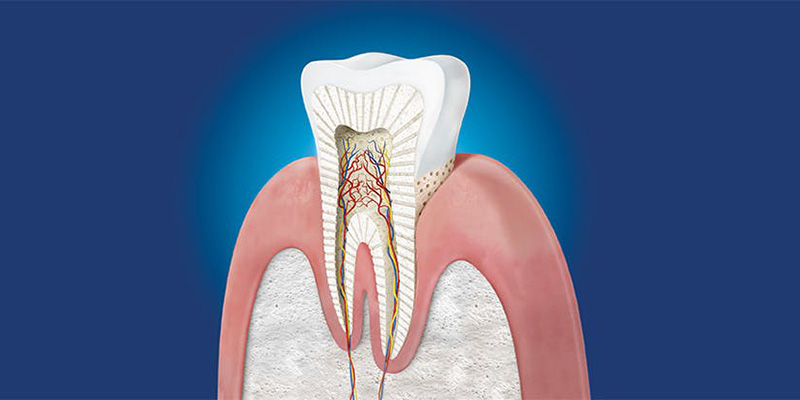 Come aiutare il dente a ripararsi naturalmente?