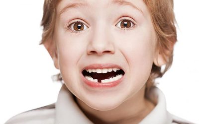 Cosa fare se a tuo figlio si rompe (o scheggia) un dente?